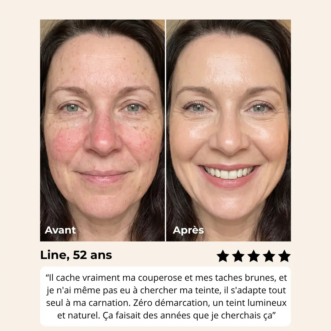 Fond de teint Melya®