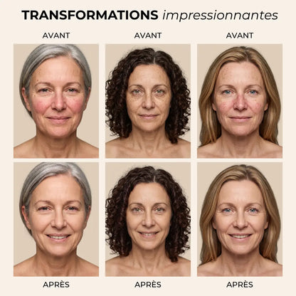 Fond de teint Melya®