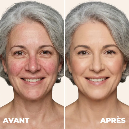 Fond de teint Melya®